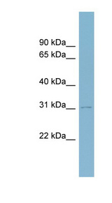 MYOD1 / MYOD antibody LS-C107937 Western blot of Fetal Spleen lysate.