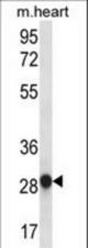 MYOGENIN Antibody western blot of mouse heart tissue lysates (35 ug/lane). The MYOGENIN antibody detected the MYOGENIN protein (arrow).