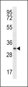 MYOGENIN Antibody western blot of ZR-75-1 cell line lysates (35 ug/lane). The MYOGENIN antibody detected the MYOGENIN protein (arrow).