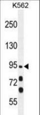 MYO19 Antibody western blot of K562 cell line lysates (35 ug/lane). The MYO19 antibody detected the MYO19 protein (arrow).