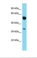 Western blot of Human Jurkat. MYO19 antibody dilution 1.0 ug/ml.