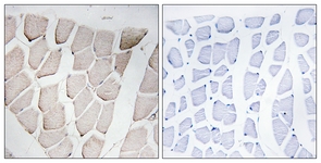 IHC of paraffin-embedded human skeletal muscle, using MYOM1 Antibody. The picture on the right is treated with the synthesized peptide.
