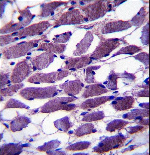 MYOM1 Antibody immunohistochemistry of formalin-fixed and paraffin-embedded human skeletal muscle followed by peroxidase-conjugated secondary antibody and DAB staining.