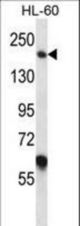MYOM1 Antibody western blot of HL-60 cell line lysates (35 ug/lane). The MYOM1 antibody detected the MYOM1 protein (arrow).