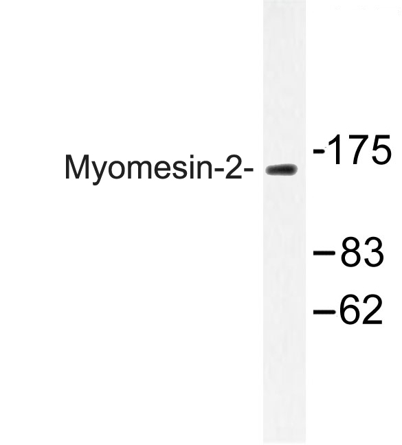 Western blot of Myomesin-2 (Y644) pAb in extracts from COS-7 cells.