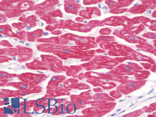Anti-MYOM2 / Myomesin 2 antibody IHC staining of human heart. Immunohistochemistry of formalin-fixed, paraffin-embedded tissue after heat-induced antigen retrieval. Antibody LS-B9842 concentration 10 ug/ml.