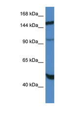 MYPN antibody LS-C145392 Western blot of HepG2 Cell lysate. Antibody concentration 1 ug/ml.