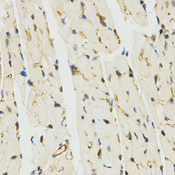Immunohistochemistry of paraffin-embedded mouse heart tissue using MYSM1 antibody at dilution of 1:200 (x400 lens)