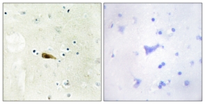 IHC of paraffin-embedded human brain tissue, using MYST1 Antibody. The sample on the right was incubated with synthetic peptide.