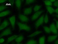 Immunostaining analysis in HeLa cells. HeLa cells were fixed with 4% paraformaldehyde and permeabilized with 0.1% Triton X-100 in PBS. The cells were immunostained with anti-MYST1 mAb.