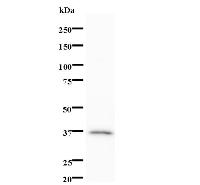 Western blot analysis of immunized recombinant protein, using anti-MYST1 monoclonal antibody.