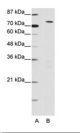 A: Marker, B: 293T Cell Lysate