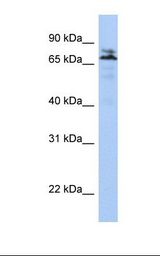 Jurkat cell lysate. Antibody concentration: 1.0 ug/ml. Gel concentration: 12%.