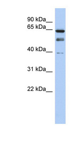 MYST2 antibody LS-C101343 Western blot of OVCAR-3 cell lysate.