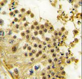 Formalin-fixed and paraffin-embedded human testis tissue reacted with HBO1/MYST2 antibody , which was peroxidase-conjugated to the secondary antibody, followed by DAB staining. This data demonstrates the use of this antibody for immunohistochemistry; clinical relevance has not been evaluated.