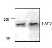 Western blot of MYST3 / MOZ antibody LS-C48645.
