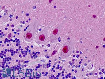 Human, Brain, cerebellum: Formalin-Fixed Paraffin-Embedded (FFPE)
