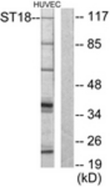 Western blot of extracts from HUVEC cells, using ZNF387 Antibody. The lane on the right is treated with the synthesized peptide.