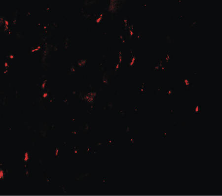 Immunofluorescence of MYT1L in human brain with MYT1L antibody at 20 ug/ml.