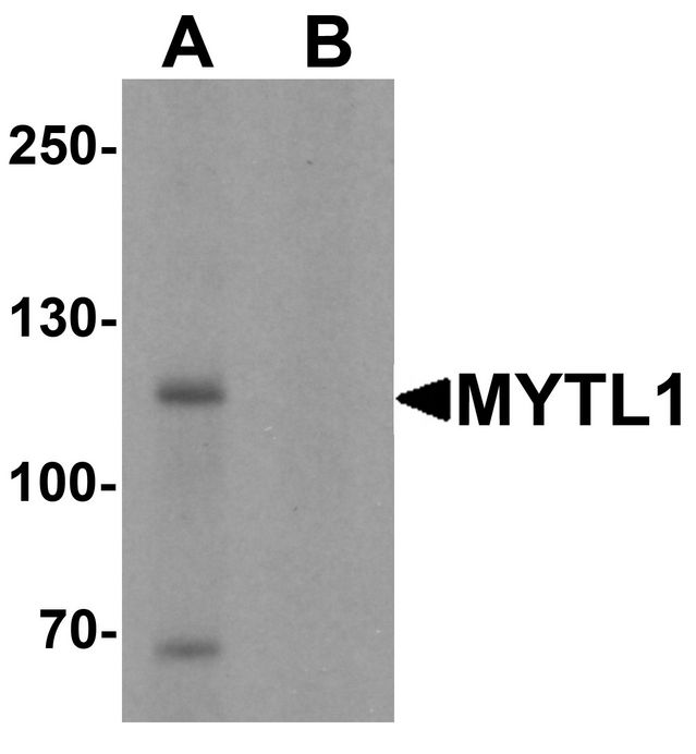 Western blot analysis of MYT1L in mouse brain tissue lysate with MYT1L antibody at 1 ug/ml in (A) the absence and (B) the presence of blocking peptide.