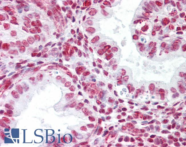 Anti-GCOM1 antibody IHC of human uterus. Immunohistochemistry of formalin-fixed, paraffin-embedded tissue after heat-induced antigen retrieval. Antibody LS-B7042 concentration 5 ug/ml.