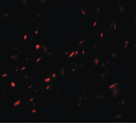 Immunofluorescence of MYOZAP in human lung tissue with MYOZAP antibody at 20 ug/ml.