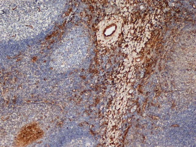 Staining of frozen Human Tonsil stained with Mouse anti Human CD206.
