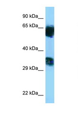 Mgat5b antibody LS-C146265 Western blot of Rat Muscle lysate. Antibody concentration 1 ug/ml.