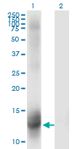 Western Blot analysis of NR3C2 expression in transfected 293T cell line by NR3C2 monoclonal antibody (M01), clone 2B5.Lane 1: NR3C2 transfected lysate (Predicted MW: 12.21 KDa).Lane 2: Non-transfected lysate.