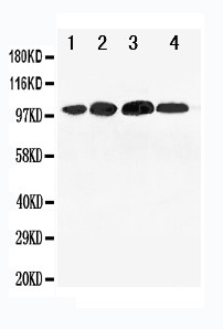 WB of Mineralocorticoid Receptor antibody. All lanes: Anti-NR3C2 at 0.5ug/ml. Lane 1: 293T Whole Cell Lysate at 40ug. Lane 2: SMMC Whole Cell Lysate at 40ug. Lane 3: SW620 Whole Cell Lysate at 40ug. Lane 4: HELA Whole Cell Lysate at 40ug. Predicted bind size: 107KD. Observed bind size: 100KD.