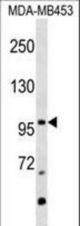 NR3C2 Antibody western blot of MDA-MB453 cell line lysates (35 ug/lane). The NR3C2 antibody detected the NR3C2 protein (arrow).
