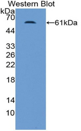 Western blot of recombinant Mineralocorticoid Receptor.