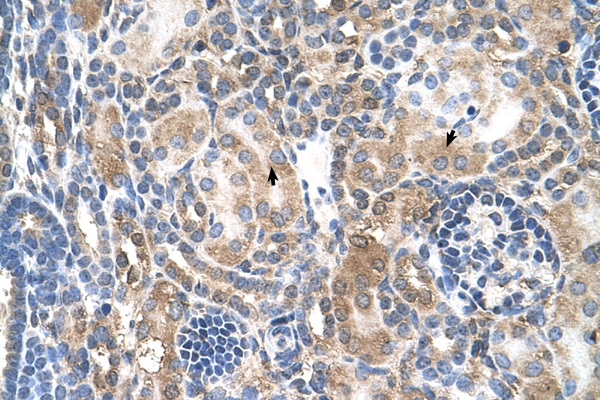 NR3C2 antibody LS-C40521 IHC of formalin-fixed, paraffin-embedded human Kidney. Positive label: Epithelial cells of renal tubule indicated with arrows. Antibody concentration 4-8 ug/ml. Magnification 400X.