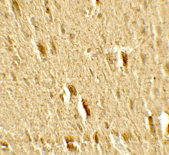 Immunohistochemistry of MFN2 in rat brain tissue with MFN2 antibody at 5 ug/mL.