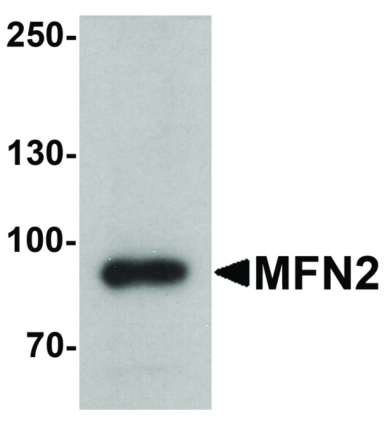 Western blot analysis of MFN2 in human brain tissue lysate with MFN2 antibody at 1 ug/ml.