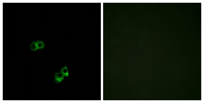 Immunofluorescence of MCF7 cells, using MC5R Antibody. The picture on the right is treated with the synthesized peptide.