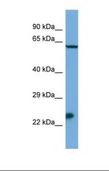 Western blot of Mouse SP2/0. Msx3 antibody dilution 1.0 ug/ml.