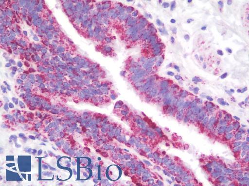 Anti-MtTFA / TFAM antibody IHC staining of human lung. Immunohistochemistry of formalin-fixed, paraffin-embedded tissue after heat-induced antigen retrieval. Antibody LS-B9989 concentration 10 ug/ml.