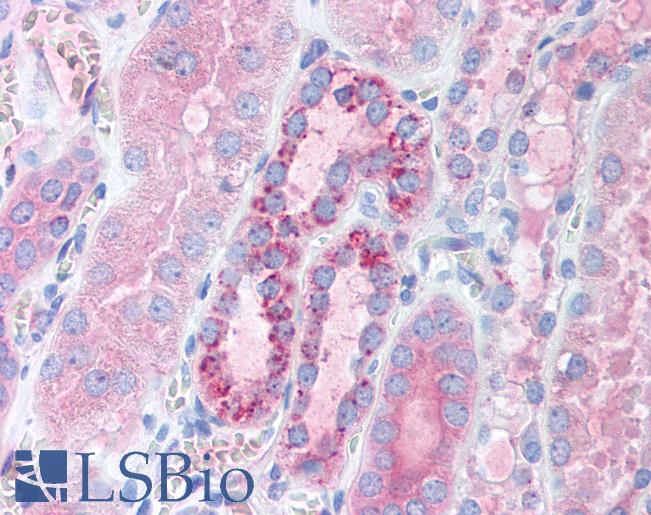 Anti-TFAM antibody IHC of human kidney. Immunohistochemistry of formalin-fixed, paraffin-embedded tissue after heat-induced antigen retrieval. Antibody LS-B1571 concentration 5 ug/ml.