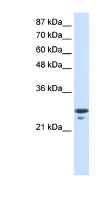 TFAM antibody LS-B1571 Western blot of Jurkat lysate.