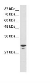 Jurkat Cell Lysate