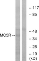 Western blot of extracts from K562 cells, using MC5R Antibody. The lane on the right is treated with the synthesized peptide.