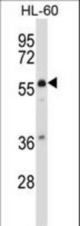 MCOLN3 Antibody western blot of HL-60 cell line lysates (35 ug/lane). The MCOLN3 antibody detected the MCOLN3 protein (arrow).