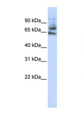 MCTP1 antibody LS-C110944 Western blot of Jurkat Cell lysate. Antibody concentration 1 ug/ml.