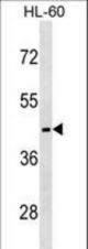 MC5R Antibody western blot of HL-60 cell line lysates (35 ug/lane). The MC5R antibody detected the MC5R protein (arrow).