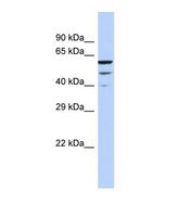 Western blot of Human HeLa. MCTP2 antibody dilution 1.0 ug/ml.