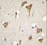 MYO6 Antibody (C-term R1181) immunohistochemistry of formalin-fixed and paraffin-embedded human brain tissue followed by peroxidase-conjugated secondary antibody and DAB staining.