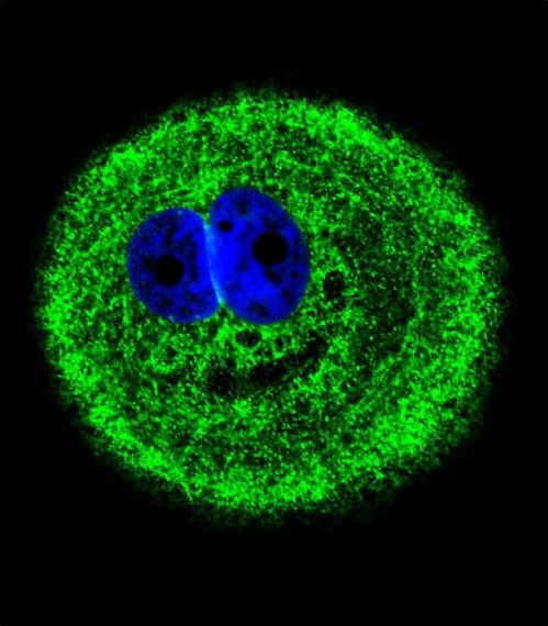 Confocal immunofluorescent of MYO6 Antibody (C-term R1181)with MCF-7 cell followed by Alexa Fluor 488-conjugated goat anti-rabbit lgG (green). DAPI was used to stain the cell nuclear (blue).