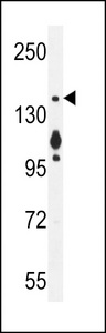 MYO6 Antibody (C-term R1181) western blot of MCF-7 cell line lysates (35 ug/lane). The MYO6 antibody detected the MYO6 protein (arrow).