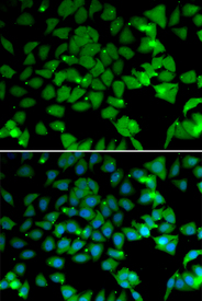 Immunofluorescence blot of U20S cell using NAA10 antibody. Blue: DAPI for nuclear staining.